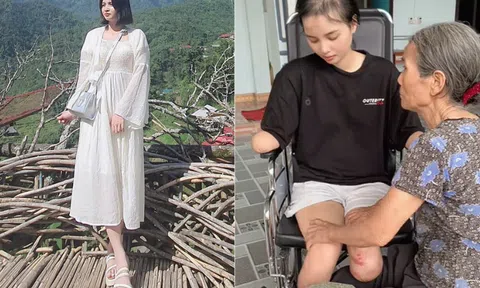 Cô gái Phú Thọ mất tứ chi trong một tháng, được mẹ chăm như trẻ sơ sinh